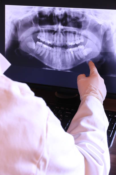 Best Emergency Tooth Extraction in Eaton Rapids, MI